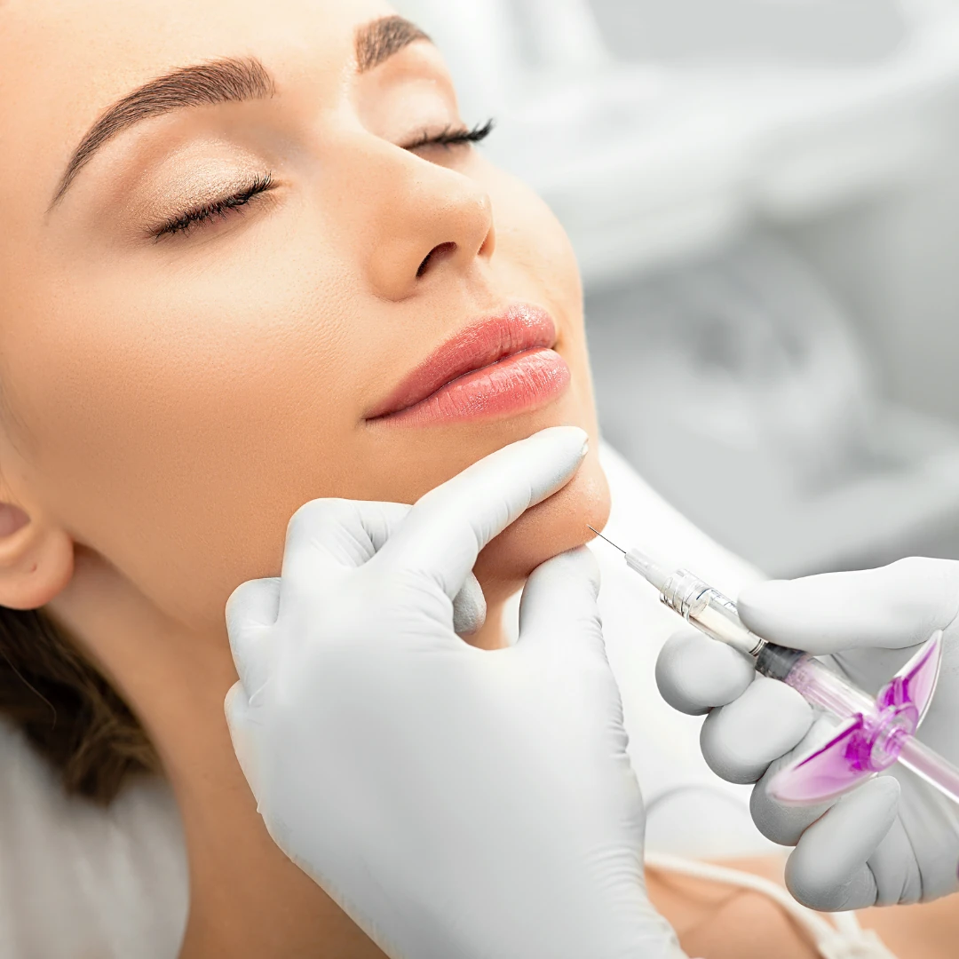 Fillers – Ácido Hialurónico