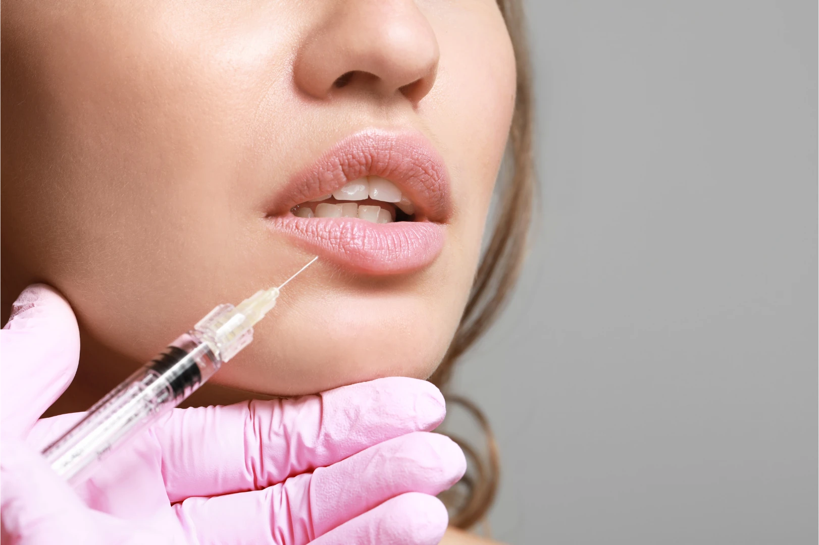 Relleno de Labios – Lip Filler