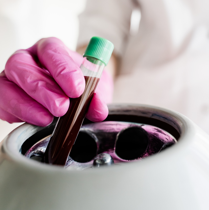 PRP – Plasma Rico en Plaquetas